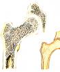 Опорная функция скелета заключается в том, что он является опорой для мышц и внутренних органов, которые, фиксируясь к костям, удерживаются в своем положении Строение рост костей скелет человека